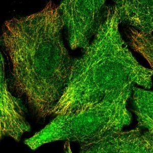 Anti-DET1 antibody produced in rabbit 