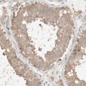 Anti-DEUP1 antibody produced in rabbit 