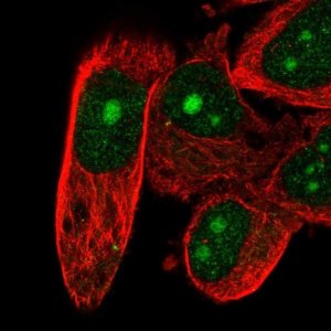 Anti-DFFB antibody produced in rabbit 