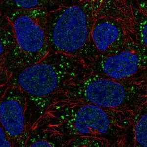 Anti-DGKA antibody produced in rabbit 