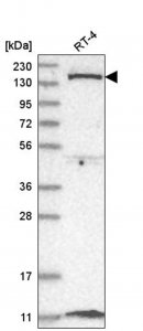 Anti-DGKD antibody produced in rabbit 