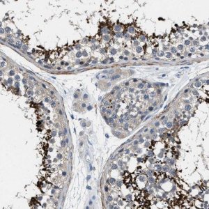 Anti-DGKE antibody produced in rabbit 
