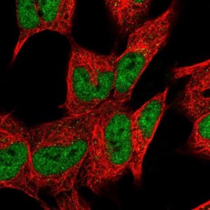 Anti-DHRS12 antibody produced in rabbit 