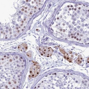Anti-DHX40 antibody produced in rabbit HPA044350-100UL