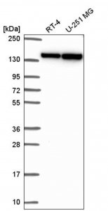 Anti-DHX9 antibody produced in rabbit 