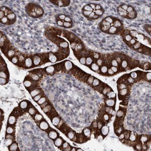 Anti-DIEXF antibody produced in rabbit 