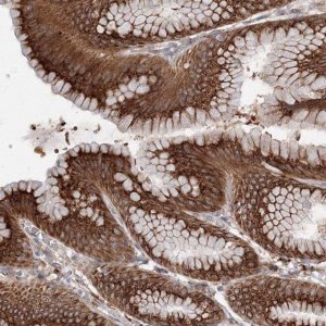 Anti-DIS3L2 antibody produced in rabbit 