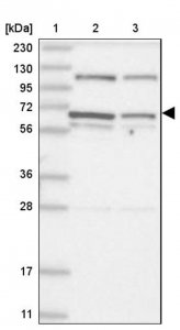 Anti-DIS3L2 antibody produced in rabbit 