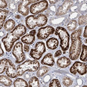 Anti-DISP1 antibody produced in rabbit 