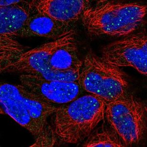 Anti-DISP1 antibody produced in rabbit 
