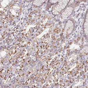 Anti-DISP2 antibody produced in rabbit 