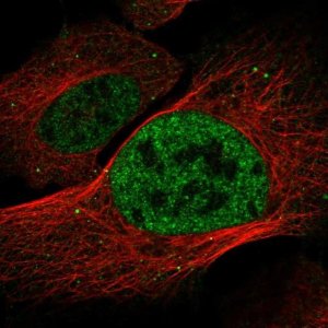 Anti-DISP2 antibody produced in rabbit 