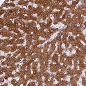Anti-DISP3 antibody produced in rabbit 