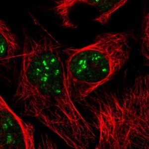 Anti-DKC1 antibody produced in rabbit 