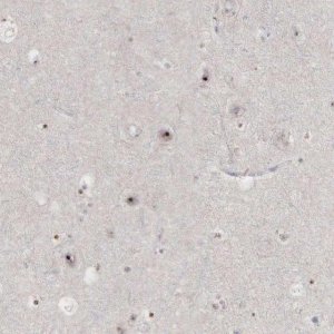 Anti-DKC1 antibody produced in rabbit HPA000166-100UL