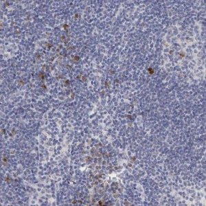Anti-DKC1 antibody produced in rabbit HPA000166-100UL