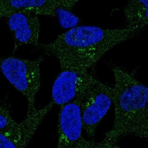 Anti-DKK2 antibody produced in rabbit 