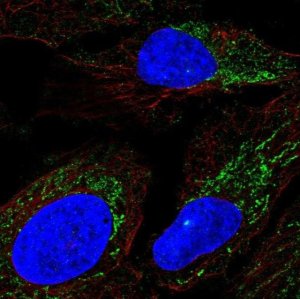 Anti-DMGDH antibody produced in rabbit 