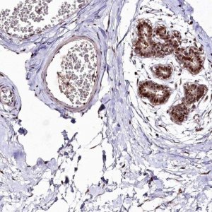 Anti-DMP1 antibody produced in rabbit 
