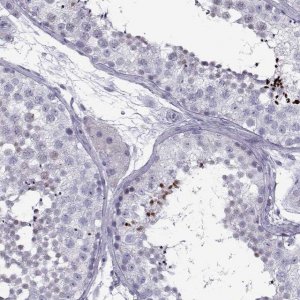 Anti-DMRT3 antibody produced in rabbit 