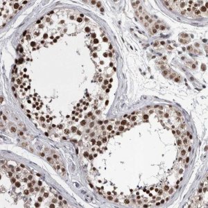 Anti-DMTF1 antibody produced in rabbit 
