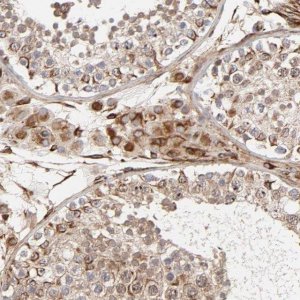 Anti-DNAAF2 antibody produced in rabbit 