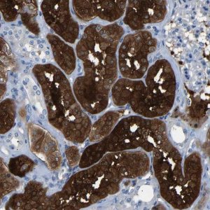 Anti-DNAAF5 antibody produced in rabbit 