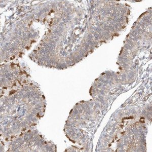Anti-DNAH1 antibody produced in rabbit 