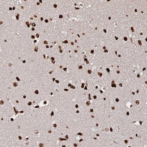 Anti-DNAH10OS antibody produced in rabbit 