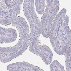Anti-DNAH11 antibody produced in rabbit 