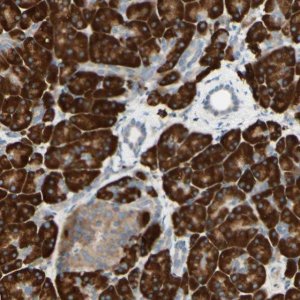 Anti-DNAJB11 antibody produced in rabbit 