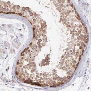 Anti-DNAJB7 antibody produced in rabbit 