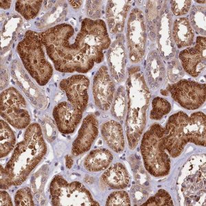 Anti-DNAJB9 antibody produced in rabbit 