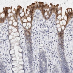 Anti-DNAJC11 antibody produced in rabbit 