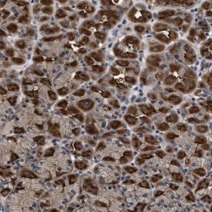 Anti-DNAJC14 antibody produced in rabbit 