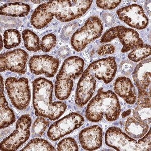 Anti-DNAJC16 antibody produced in rabbit 