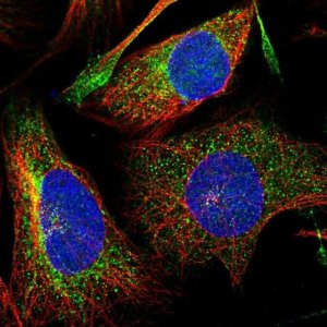 Anti-DNAJC16 antibody produced in rabbit 