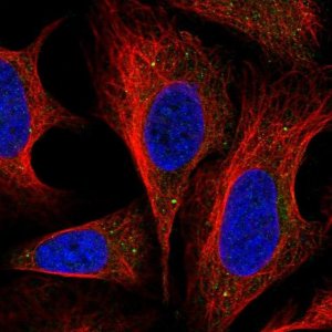 Anti-DNAJC22 antibody produced in rabbit 