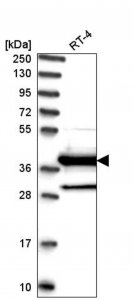 Anti-DNAJC22 antibody produced in rabbit 
