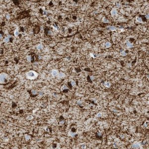 Anti-DNAJC30 antibody produced in rabbit 