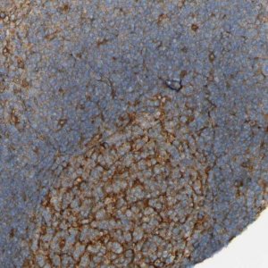 Anti-DNAJC4 antibody produced in rabbit 