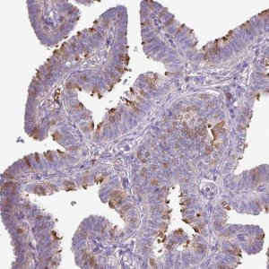 Anti-DNAL1 antibody produced in rabbit 