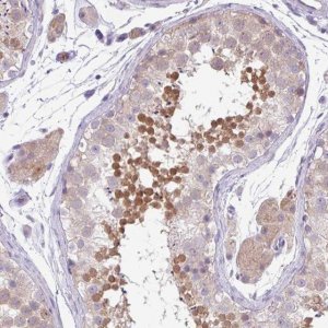 Anti-DNAL1 antibody produced in rabbit 