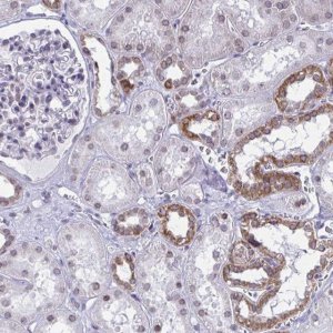 Anti-DOCK11 antibody produced in rabbit 