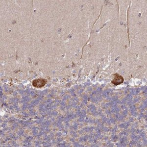 Anti-DOCK9 antibody produced in rabbit 