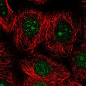Anti-DOLK antibody produced in rabbit 