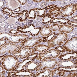 Anti-DPAGT1 antibody produced in rabbit 