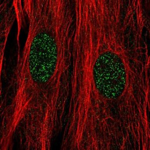 Anti-DPF3 antibody produced in rabbit 