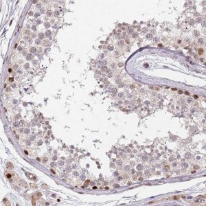 Anti-DPH2 antibody produced in rabbit 