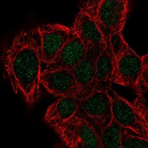 Anti-DPH2 antibody produced in rabbit 